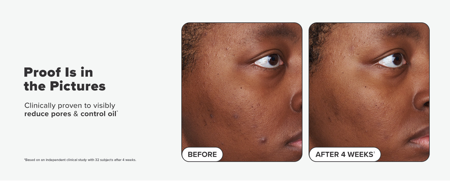 Paula's Choice SKIN PERFECTING 2% BHA Liquid Salicylic Acid Exfoliant-Facial Exfoliant for Blackheads, Enlarged Pores, Wrinkles & Fine Lines 24hrsmart